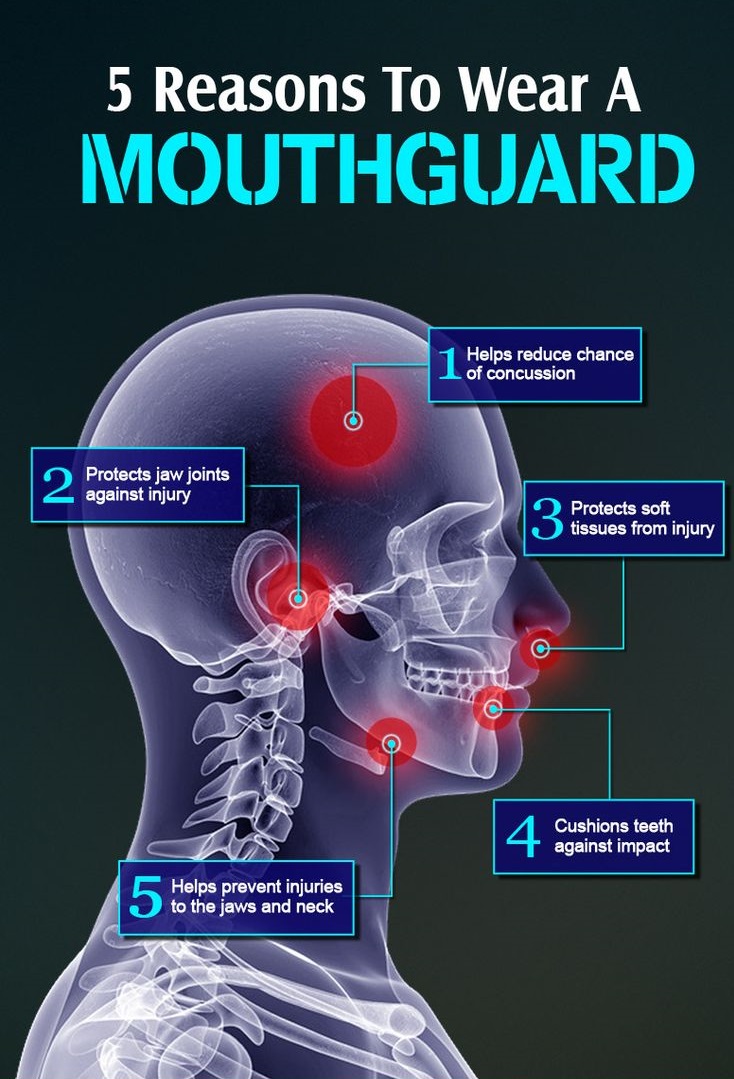% reasons to wear a mouthguard